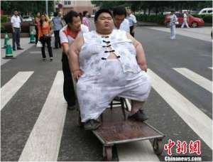 “中国第一胖”男子就医 一年减肥81公斤(组图)