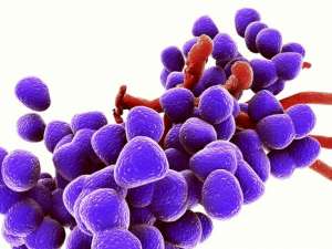 美国老太感染超级细菌身亡 对26种抗生素无反应
