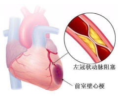 欣康单硝酸异山梨酯片作用是什么